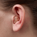 aparelho-auditivo-intracanal