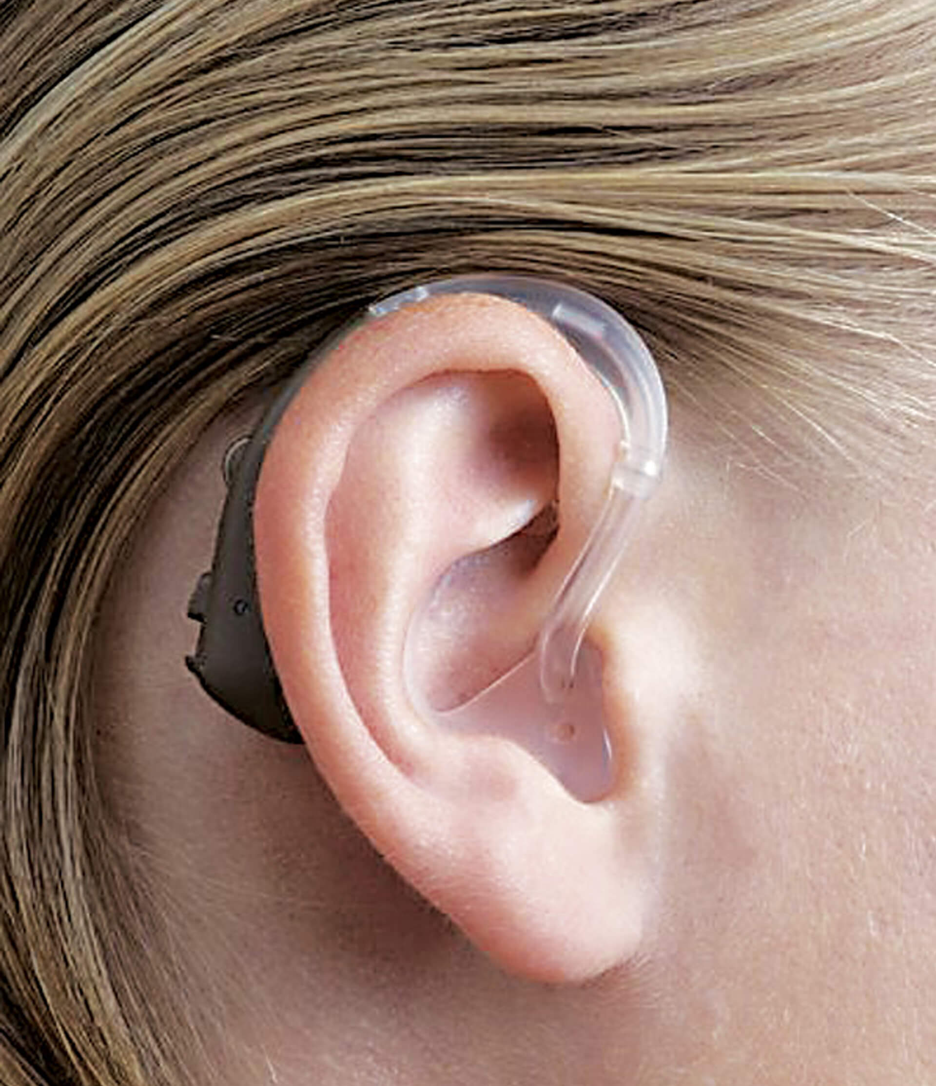 Quando um aparelho auditivo retroauricular é indicado